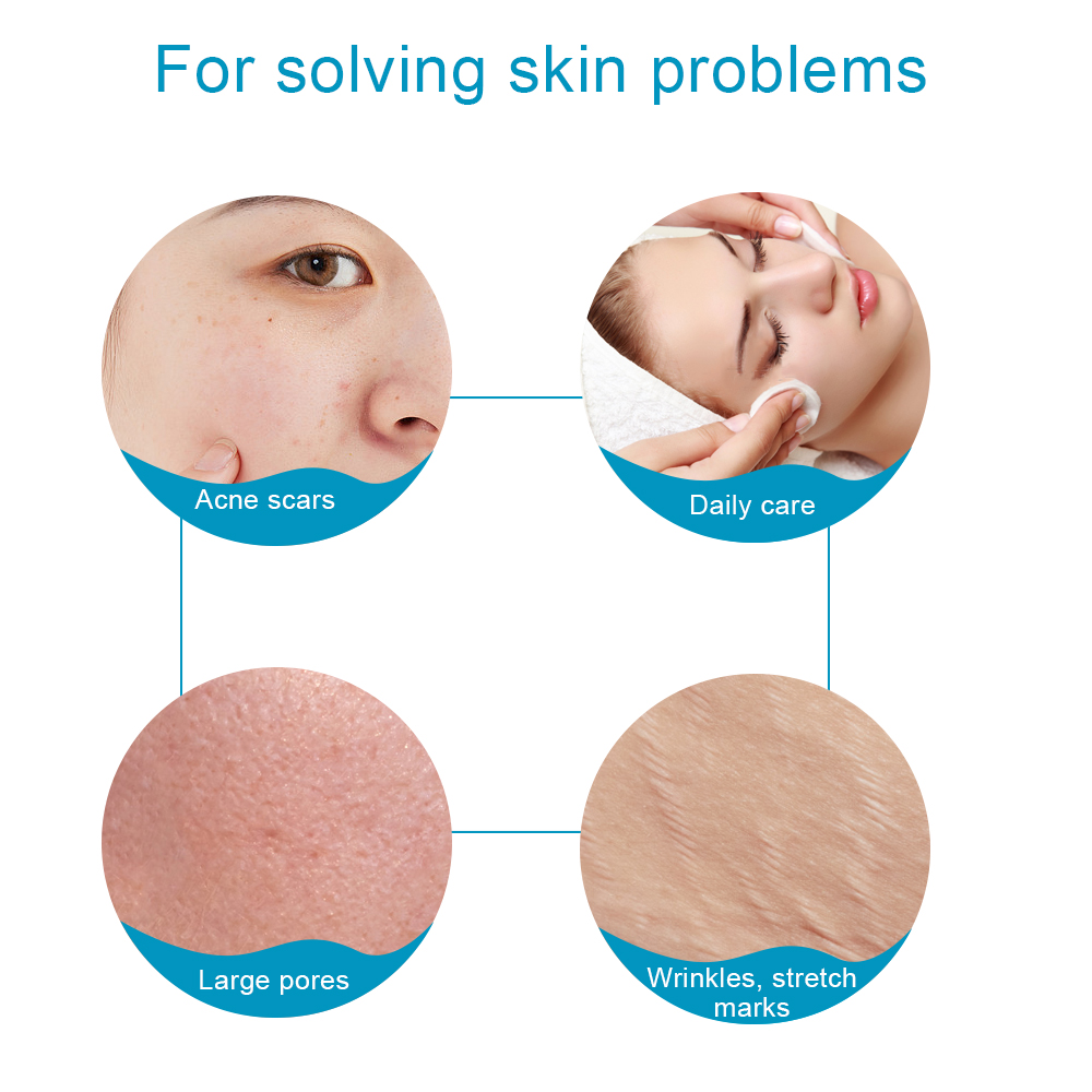 1 шт. титановый дермароллер 54 – обзор и цена Derma Roller 0.25